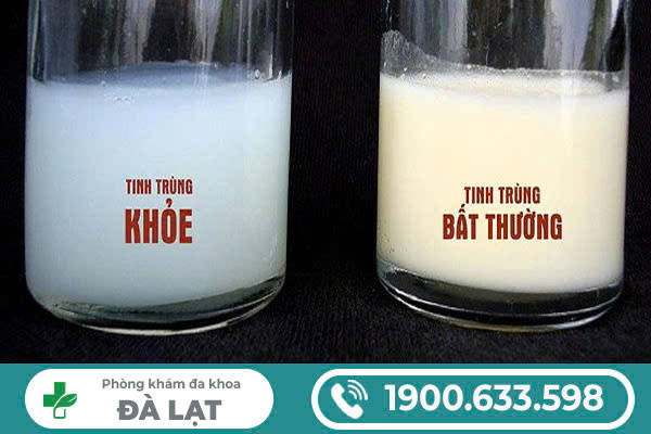 Hình ảnh minh họa